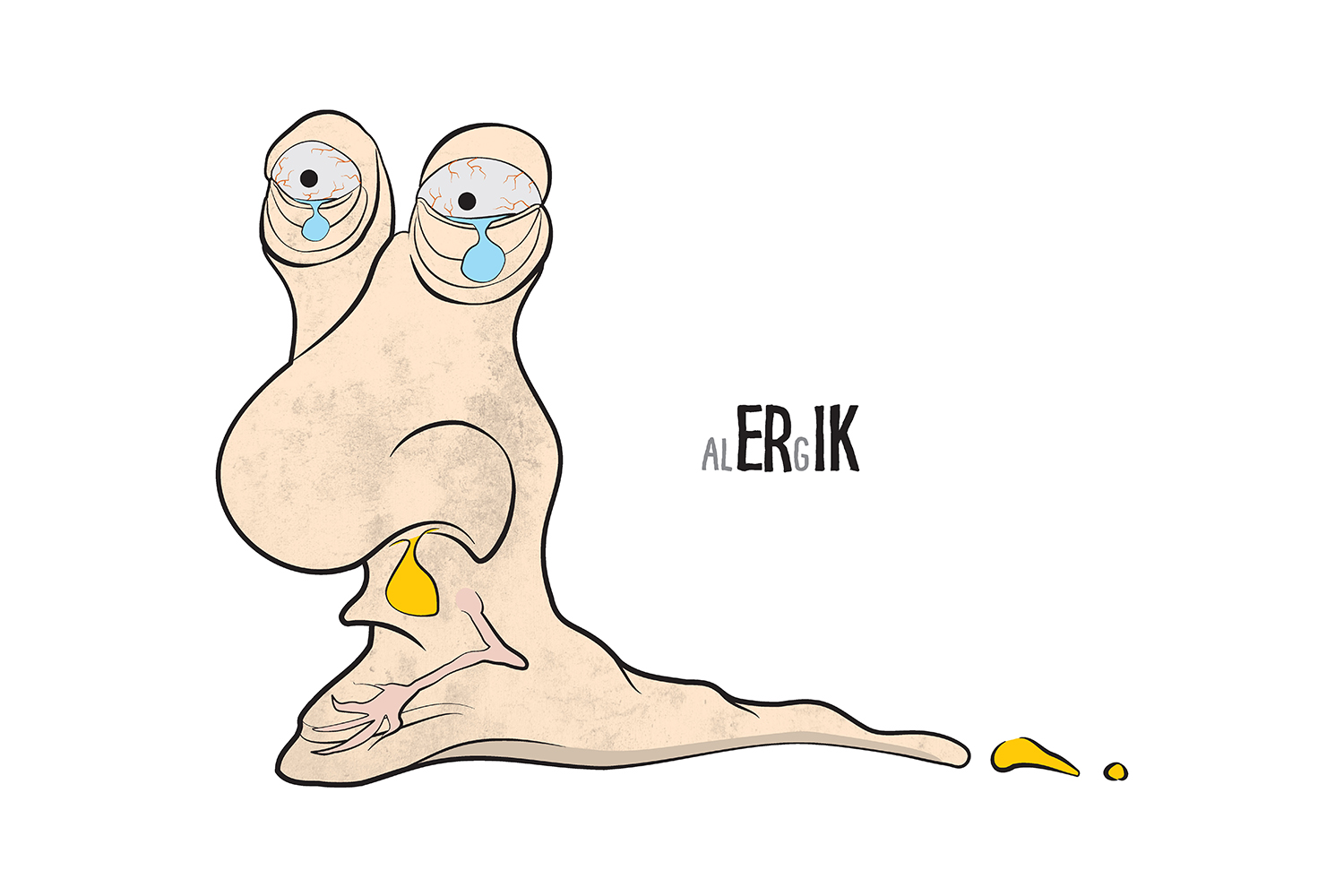 alERgIK
